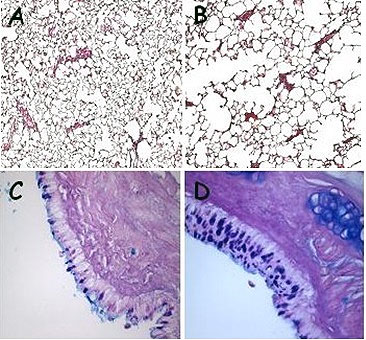 Photomicrographs of H & E staining for histological changes (A and B), and PAS staining for mucin-containing goblet cells (C and D) of rat lung and airway sections after exposure to sham air (A and C) and cigarette smoke (B and D). Cigarette smoke caused alveolar wall destruction (B) and an increase in the number of mucin-containing goblet cells (D).