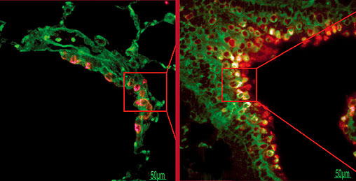 Photomicrographs of mitochondrial transfer from human MSCs to lung cells in cigarette smoke-exposed rat lung sections under fluorescent microscope. Clara cell secretory protein (CC)-10 labelled red (Alexa Fluor 594) detecting lung epithelial cells, human/rat Complex I labelled green (Alexa Fluor 488) detecting human/rat mitochondria, and human Cox-4 labelled violet (Alexa Fluor 660) detecting human mitochondria only. Colocalization of red and violet signals indicates the adoption of human mitochondria by lung epithelium. (Cover page for American Journal of Respiratory Cell and Molecular Biology, 2014; Volume 51, Issue 3)